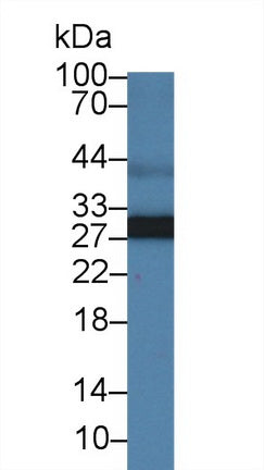 Western Blot; Sample: Recombinant protein.