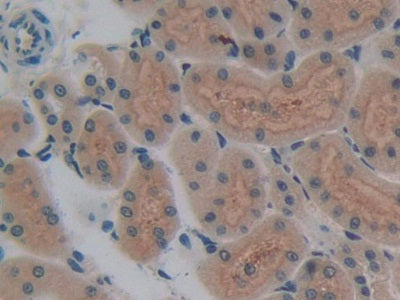 DAB staining on fromalin fixed paraffin- embedded liver tissue)