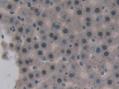 Superoxide Dismutase Copper Chaperone (Superoxide Dismutase Copper Chaperone) Polyclonal Antibody - image 4