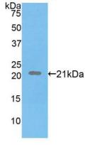 Fibrillin 1 (FBN1) Polyclonal Antibody - image 2