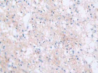 DAB staining on IHC-P; Samples: Human Liver Tissue