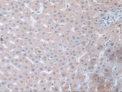 Fibrillin 1 (FBN1) Polyclonal Antibody - image 4