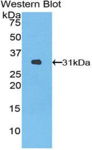 Heme Oxygenase 2, Decycling (HO2) Polyclonal Antibody - image 2