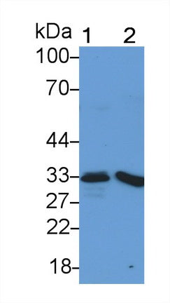 DAB staining on IHC-P; Samples: Porcine Spleen Tissue; Primary Ab: 20µg/ml Rabbit Anti-Porcine HO1 Antibody Second Ab: 2µg/mL HRP-Linked Caprine Anti-Rabbit IgG Polyclonal Antibody