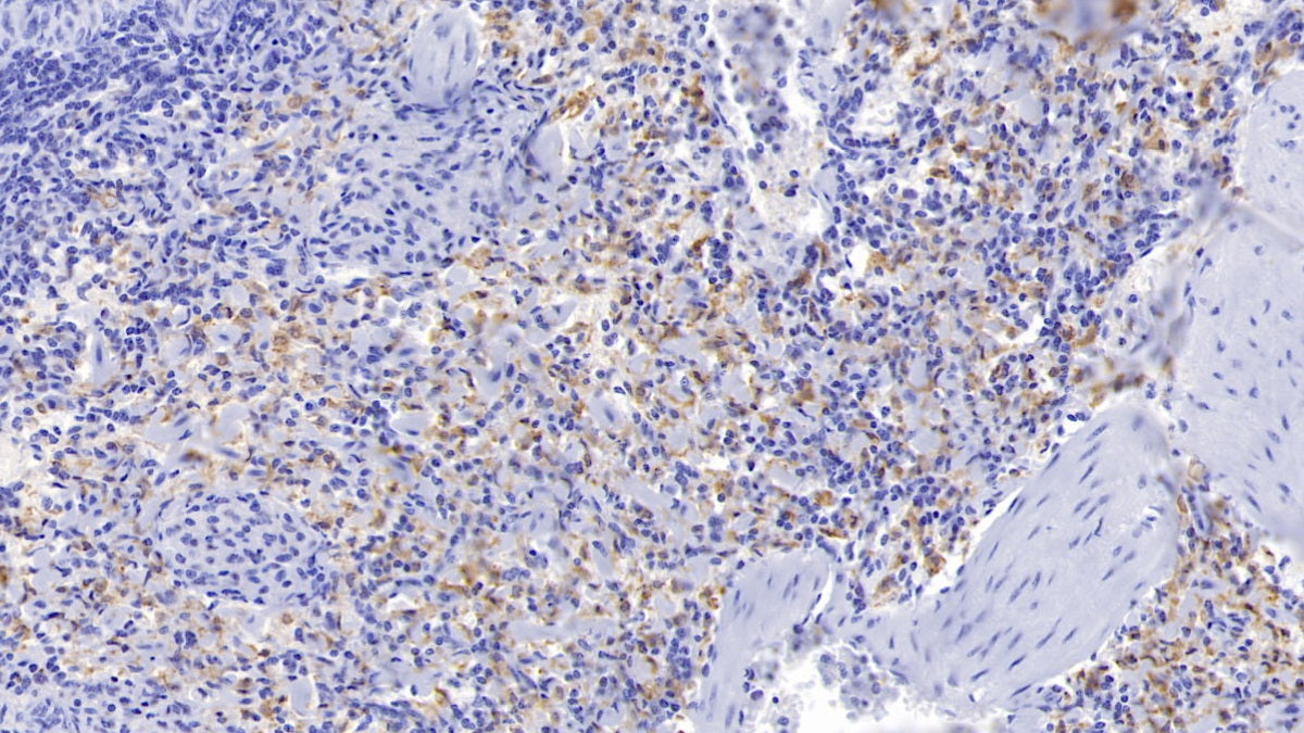 DAB staining on IHC-P; Samples: Porcine Liver Tissue; Primary Ab: 20µg/ml Rabbit Anti-Porcine HO1 Antibody Second Ab: 2µg/mL HRP-Linked Caprine Anti-Rabbit IgG Polyclonal Antibody