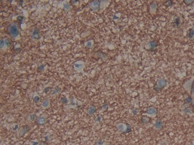 DAB staining on IHC-P; Samples: Human Brain Tissue.