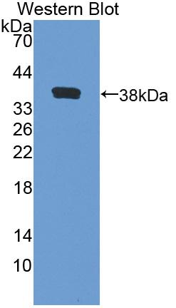Western Blot; Sample: Lane1: Human Placenta lysate; Lane2: Porcine Skeletal muscle lysate; Lane3: Porcine Heart lysate; Lane4: Mouse Pancreas lysate; Primary Ab: 1μg/ml Rabbit Anti-Human AQP1 Antibody; Second Ab: 0.2µg/mL HRP-Linked Caprine Anti-Rabbit IgG Polyclonal Antibody;