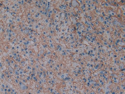 DAB staining on fromalin fixed paraffin- embedded kidney tissue)