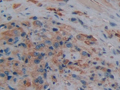 Aquaporin 1 (AQP1) Polyclonal Antibody - image 5