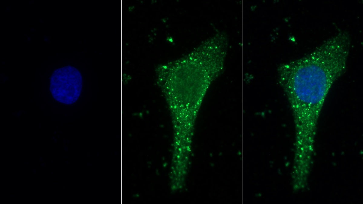 Laminin Alpha 1 (LAMA1) Polyclonal Antibody - image 3