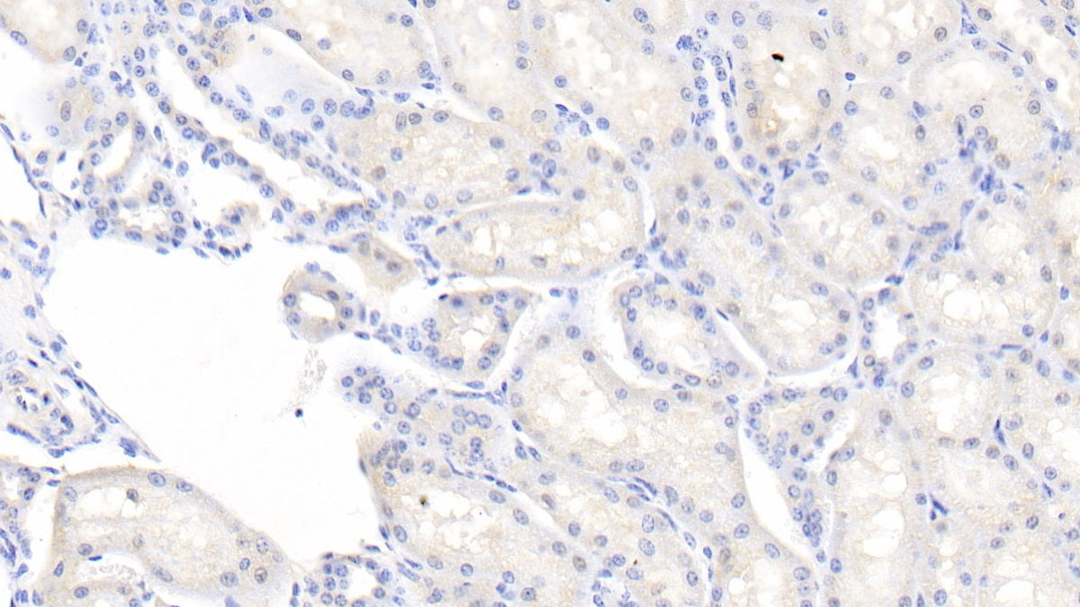 DAB staining on IHC-P; Samples: Bovine Testis Tissue; Primary Ab: 20μg/ml Rabbit Anti-Bovine IL1b Antibody Second Ab: 2µg/mL HRP-Linked Caprine Anti-Rabbit IgG Polyclonal Antibody