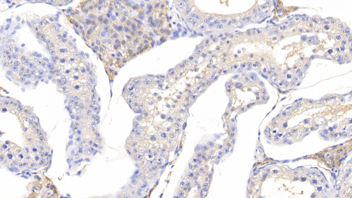 Interleukin 1 Beta (IL1b) Polyclonal Antibody - image 4