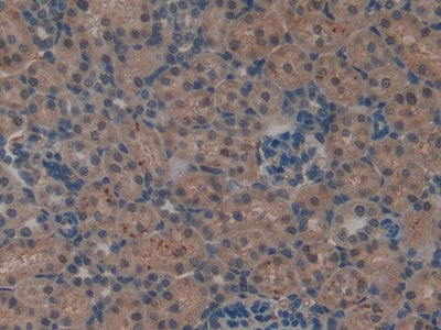 DAB staining on fromalin fixed paraffin- embedded kidney tissue)