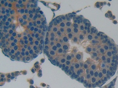 Leukemia Inhibitory Factor Receptor (LIFR) Polyclonal Antibody - image 5