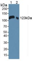 Western Blot; Sample: Recombinant LIFR, Mouse.