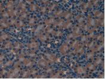 Leukemia Inhibitory Factor Receptor (LIFR) Polyclonal Antibody - image 4