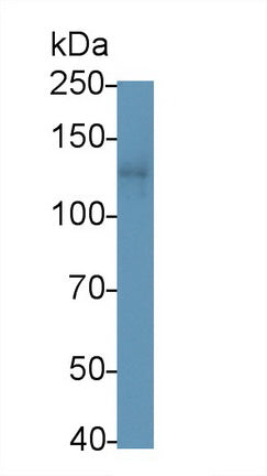 Leukemia Inhibitory Factor Receptor (LIFR) Polyclonal Antibody - image 2