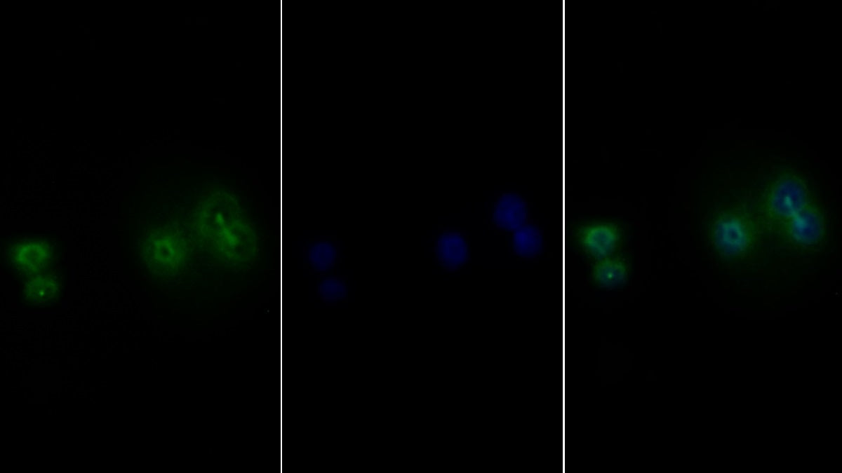 Leukemia Inhibitory Factor Receptor (LIFR) Polyclonal Antibody - image 3