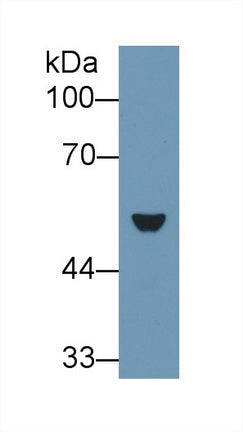 Western Blot; Sample: Recombinant protein.