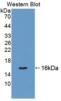 DAB staining on IHC-P; Samples: Rat Uterus Tissue; Primary Ab: 10μg/ml Rabbit Anti-Rat KRT7 Antibody Second Ab: 2µg/mL HRP-Linked Caprine Anti-Rabbit IgG Polyclonal Antibody