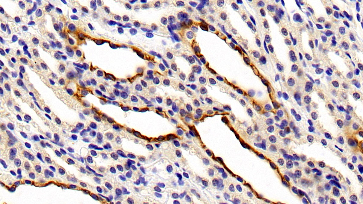 Cytokeratin 7 (CK7) Polyclonal Antibody - image 5
