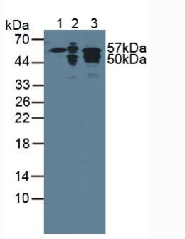 Western Blot; Sample: Recombinant KRT7, Human.