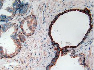 Cytokeratin 7 (CK7) Polyclonal Antibody - image 5
