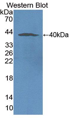 Nicotinamide Adenine Dinucleotide Phosphate Oxidase 5 (NOX5) Polyclonal Antibody - image 2
