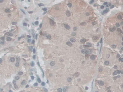 DAB staining on fromalin fixed paraffin- embedded Kidney tissue)