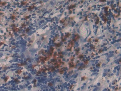 DAB staining on IHC-P; Samples: Human Stomach Tissue