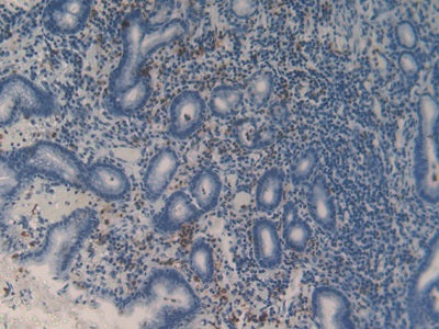 Matrix Metalloproteinase 9 (MMP9) Polyclonal Antibody - image 5