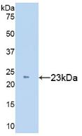 Tissue Inhibitors Of Metalloproteinase 1 (TIMP1) Polyclonal Antibody - image 2