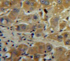 Tissue Inhibitors Of Metalloproteinase 1 (TIMP1) Polyclonal Antibody - image 3