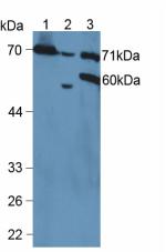 Western Blot; Sample: Lane1: Human Hela cell lysate; Lane2: Mouse Kidney lysate; Lane3: Rat Spleen lysate ; Primary Ab: 5µg/ml Rabbit Anti-Human VCAM1 Antibody; Second Ab: 0.2µg/ml HRP-Linked Caprine Anti-Rabbit IgG Polyclonal Antibody;