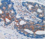 Vascular Cell Adhesion Molecule 1 (VCAM1) Polyclonal Antibody - image 5