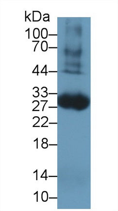 Western Blot; Sample: Recombinant protein.