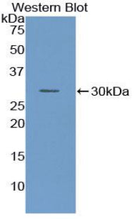 DAB staining on IHC-P; Samples: Rat Pancreas Tissue;  Primary Ab: 20μg/ml Rabbit Anti-Rat TF Antibody Second Ab: 2µg/mL HRP-Linked Caprine Anti-Rabbit IgG Polyclonal Antibody