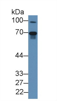Western Blot; Sample: Recombinant protein.