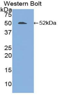DAB staining on IHC-P; Samples: Human Colon Tissue; Primary Ab: 20μg/ml Rabbit Anti-Human FGL2 Antibody Second Ab: 2µg/mL HRP-Linked Caprine Anti-Rabbit IgG Polyclonal Antibody