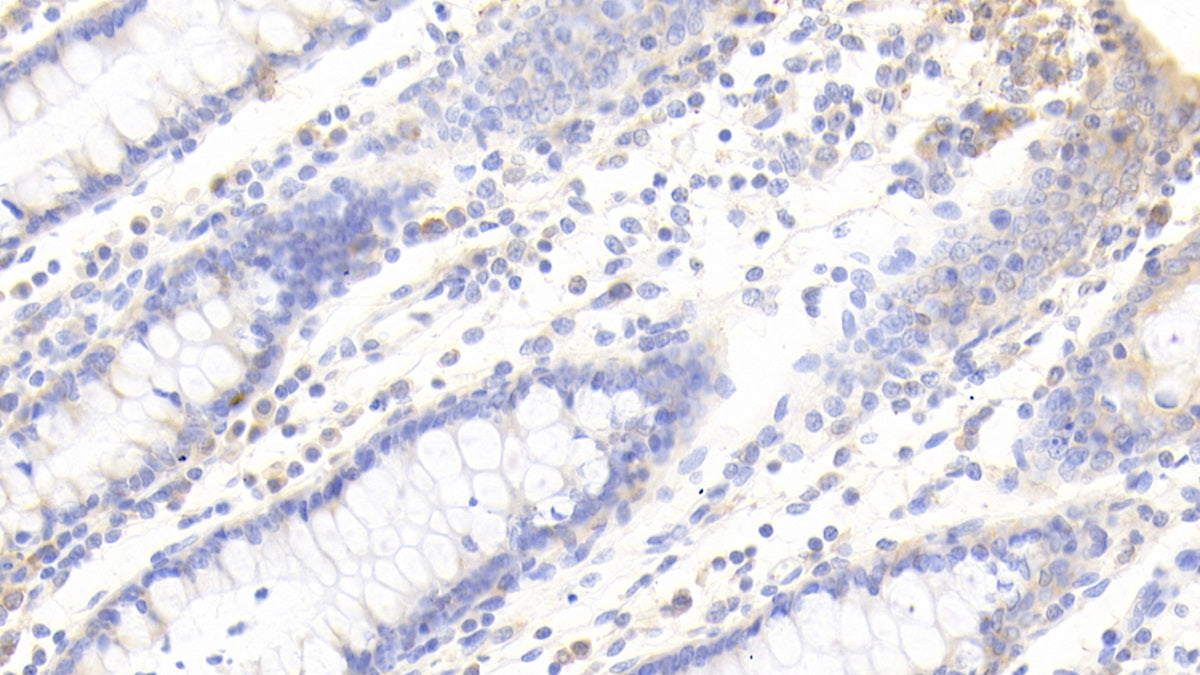DAB staining on IHC-P. Samples: Human Tissue)