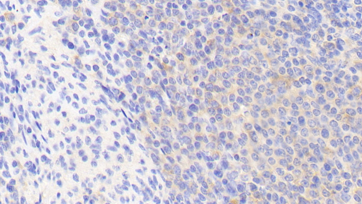 Fibrinogen Like Protein 2 (FGL2) Polyclonal Antibody - image 5
