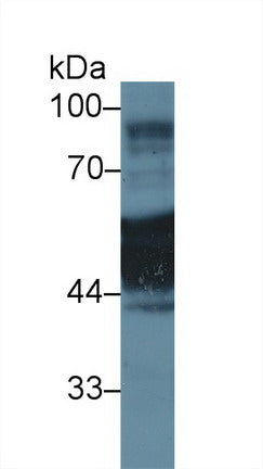 Western Blot; Sample: Recombinant protein.