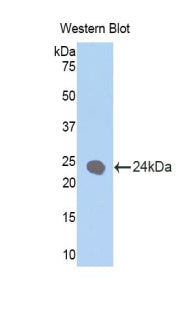 DAB staining on IHC-P; Samples: Rat Kidney Tissue; Primary Ab: 20µg/ml Rabbit Anti-Rat KRT1 Antibody Second Ab: 2µg/mL HRP-Linked Caprine Anti-Rabbit IgG Polyclonal Antibody