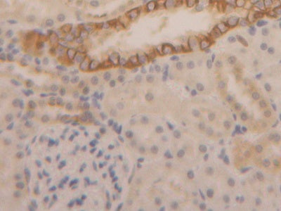 DAB staining on IHC-P; Samples: Rat Kidney Tissue)