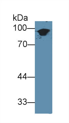 Western Blot; Sample: Rat Skin lysate; Primary Ab: 3µg/ml Rabbit Anti-Mouse KRT1 Antibody Second Ab: 0.2µg/mL HRP-Linked Caprine Anti-Rabbit IgG Polyclonal Antibody