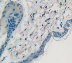 Cytokeratin 1 (CK1) Polyclonal Antibody - image 4