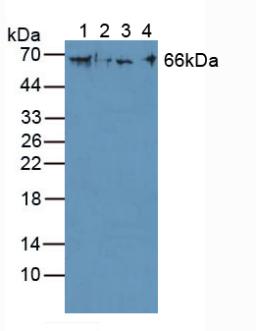 Knockout Varification: <br/>Lane 1: Wild-type A431 cell lysate; <br/>Lane 2: KRT1 knockout A431 cell lysate; <br/>Predicted MW: 66kDa <br/>Observed MW: 66kDa<br/>Primary Ab: 3µg/ml Rabbit Anti-Human KRT1 Antibody<br/>Second Ab: 0.2µg/mL HRP-Linked Caprine Anti-Rabbit IgG Polyclonal Antibody<br/>