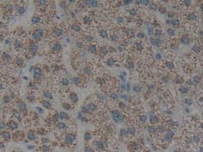Cytokeratin 1 (CK1) Polyclonal Antibody - image 5