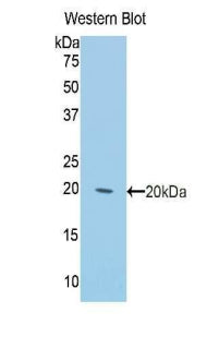 Knockout Varification: <br/>Lane 1: Wild-type A431 cell lysate; <br/>Lane 2: KRT2 knockout A431 cell lysate; <br/>Predicted MW: 69kDa <br/>Observed MW: 69kDa<br/>Primary Ab: 1µg/ml Rabbit Anti-Rat KRT2 Antibody<br/>Second Ab: 0.2µg/mL HRP-Linked Caprine Anti-Rabbit IgG Polyclonal Antibody<br/>