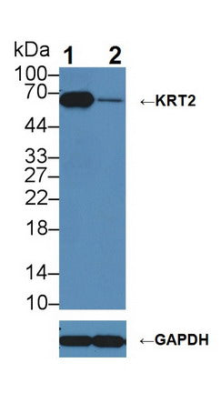Keratin 2 (CK2) Polyclonal Antibody - image 3